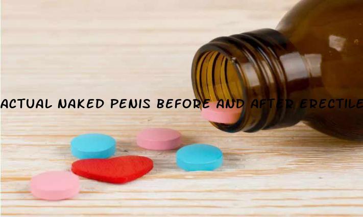 Actual Naked Penis Before And After Erectile Dysfunction Drugs Testicular Torsion Sexuall Health